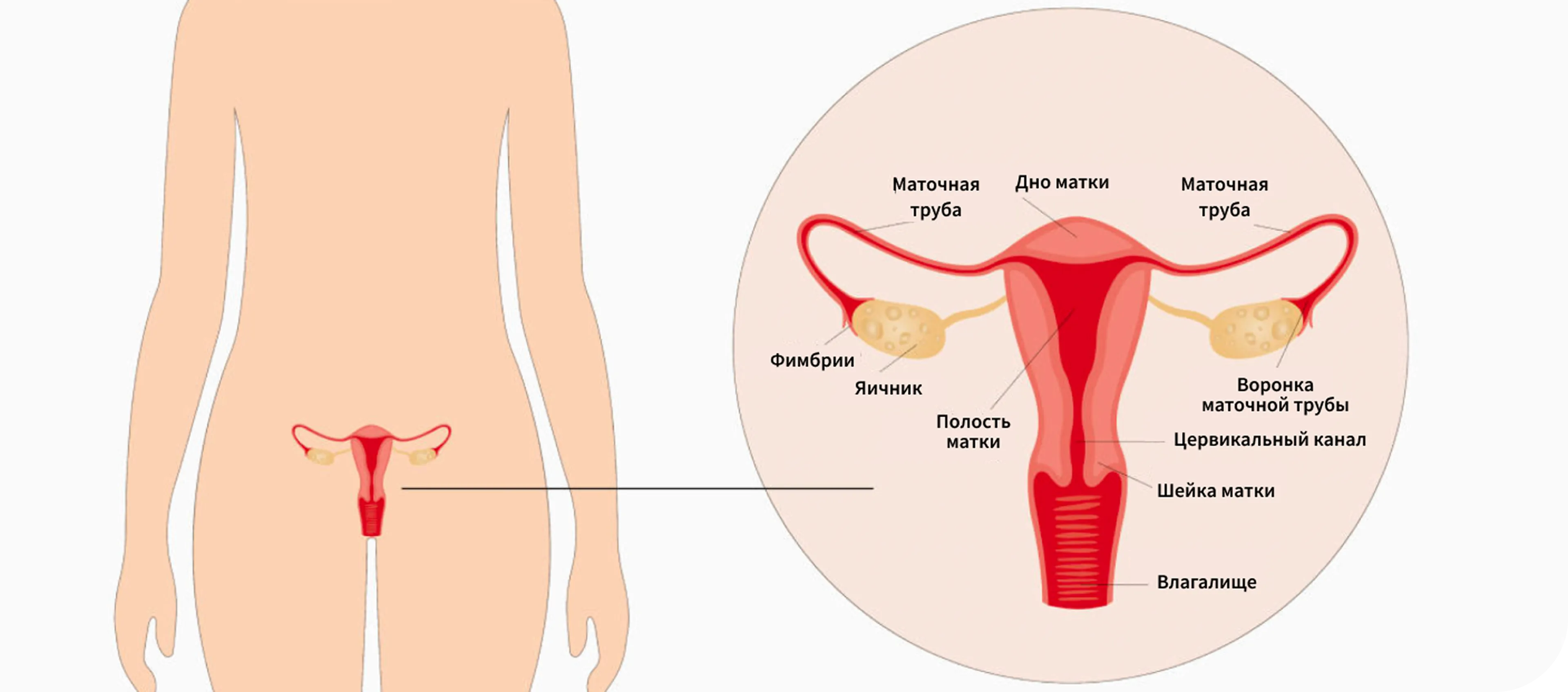 endometrial-carcinoma